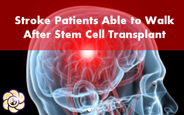 Stroke patients able to walk again after stem cell transplant