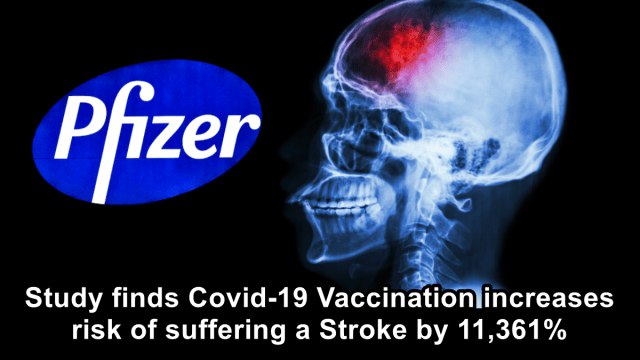 Study finds Covid-19 Vaccination increases risk of suffering a Stroke by 11,361%