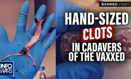 MUST SEE: Mortician Finds Massive Hand-Sized Clots In Cadavers After Vax