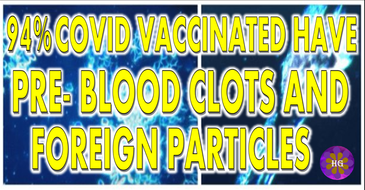 Covid Injection Aftermath: Study finds 94% of “Vaccine” Recipients have Pre-Blood Clot Formations and Foreign Particles