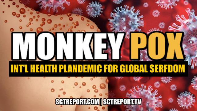 MONKEY HOAX: INTERNATIONAL HEALTH PLANDEMIC FOR GLOBAL SERFDOM