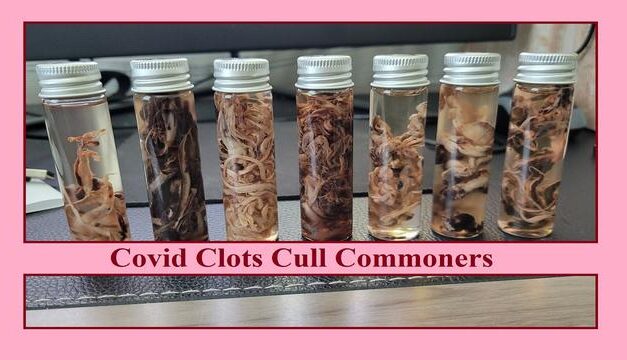 Covid Clots Cull Commoners