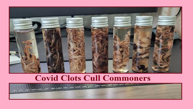 Covid Clots Cull Commoners