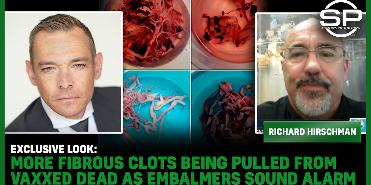 EXCLUSIVE LOOK: MORE Fibrous Clots Being Pulled From Vaxxed DEAD As Embalmers Sound Alarm