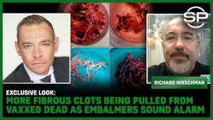 EXCLUSIVE LOOK MORE Fibrous Clots Being Pulled From Vaxxed DEAD As Embalmers Sound Alarm