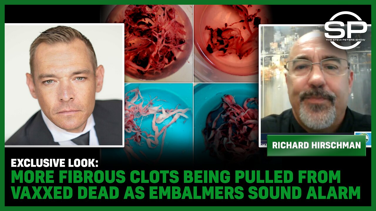 EXCLUSIVE LOOK MORE Fibrous Clots Being Pulled From Vaxxed DEAD As Embalmers Sound Alarm