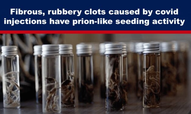 Fibrous, rubbery clots caused by covid injections have prion-like seeding activity