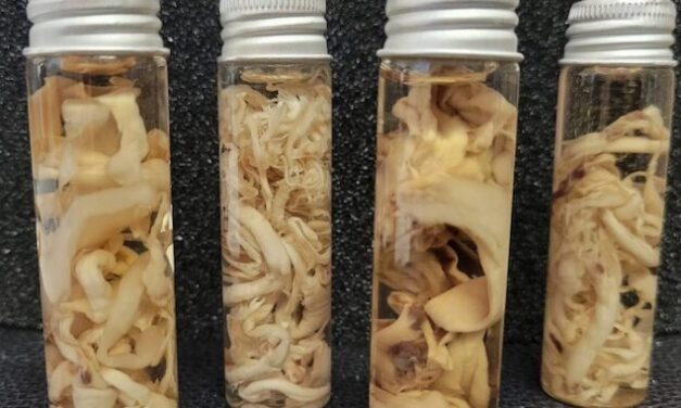 Top Scientists Drop Bombshell: ‘White Fibrous Clots Being Found in Millions of mRNA Recipients’
