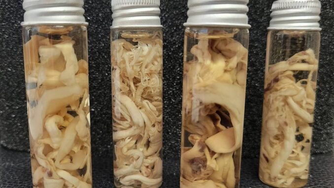 Top Scientists Drop Bombshell: ‘White Fibrous Clots Being Found in Millions of mRNA Recipients’