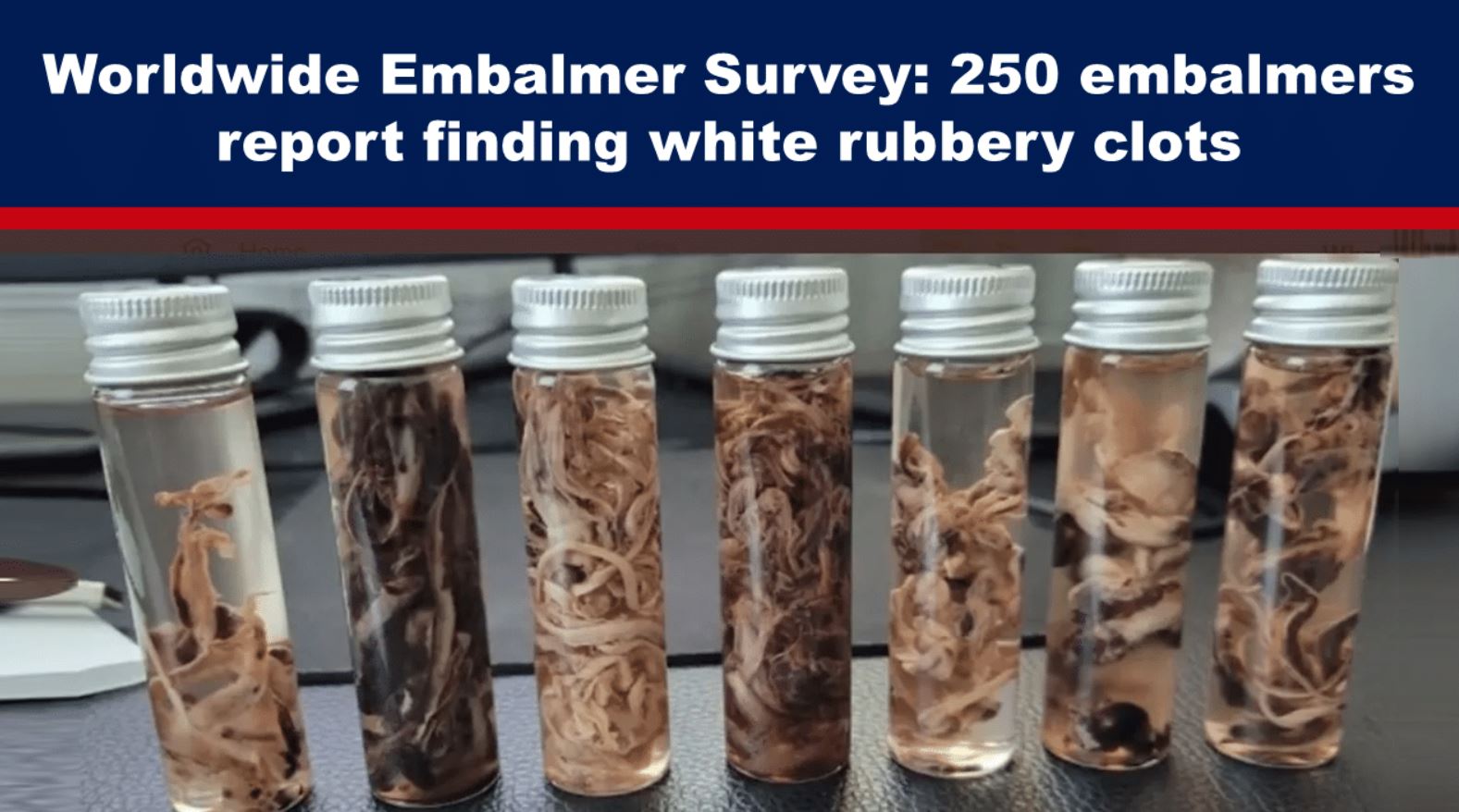 embalmer survey