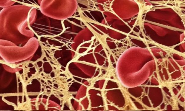 Scientists Warn Fibrous Clots Are Surging in Kids of COVID-Vaxxed Moms