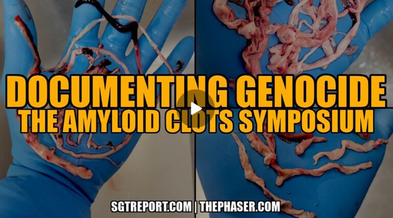 amyloid clots