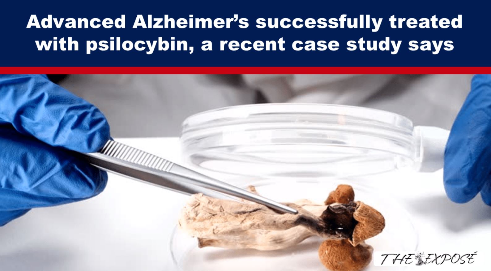 psilocybin treated